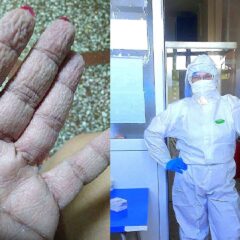 ОВО СУ РУКЕ ШАБАЧКИХ МЕДИЦИНАРА